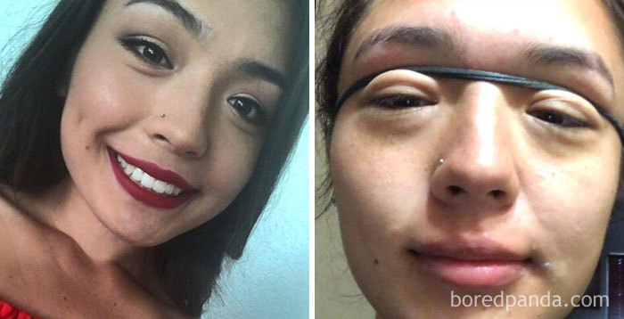 I’m Sorry You Have To See This