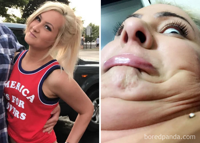 My Armpit And Neck Rolls Are Twinning