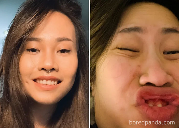 Very Proud Of My Freckles Though