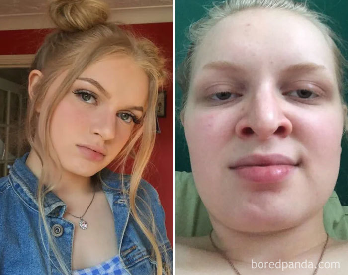 I Have Very Flexible Nostrils