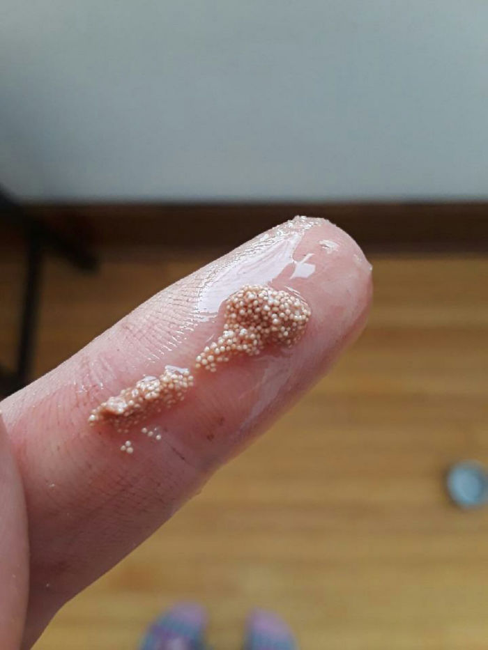 Found Inside The White Of An Egg. Are These More, Future Eggs That Unfortunately Got Inside Another Egg? Did The Chicken Lose All Future Eggs? A Parasite?