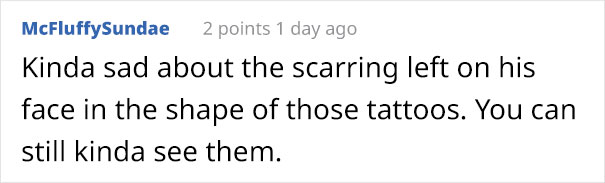 Comment about scars remaining after racist tattoos removal. Comment about scars remaining after racist tattoos removal.