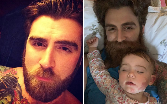 Check Out That Beard Growth! Somebody’s Been Drinking Giant’s Milk!