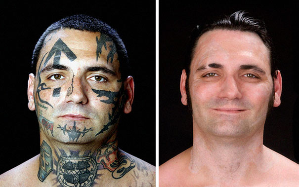 Man showing removal of racist tattoos, with before and after images.