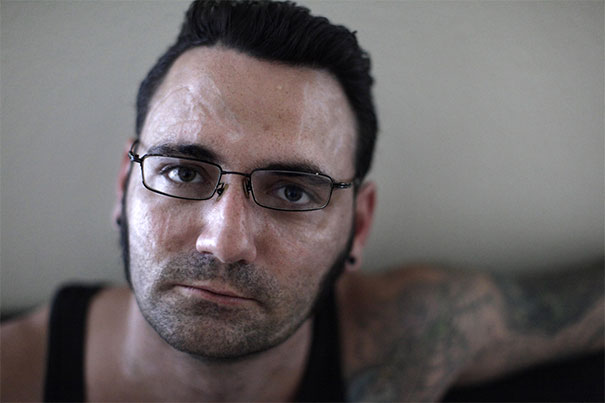 Man with glasses and tattoos after removing racist tattoos, sitting in a thoughtful pose.