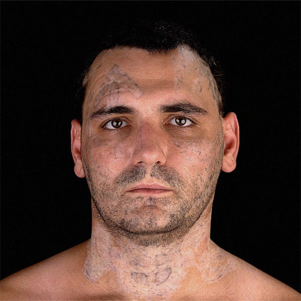 Man with removed tattoos on face and neck, highlighting transformation and change in beliefs. Man with removed tattoos on face and neck, highlighting transformation and change in beliefs.