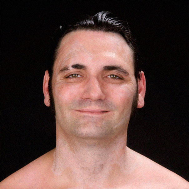 Man smiles after racist tattoos removed, symbolizing change and new beginnings.