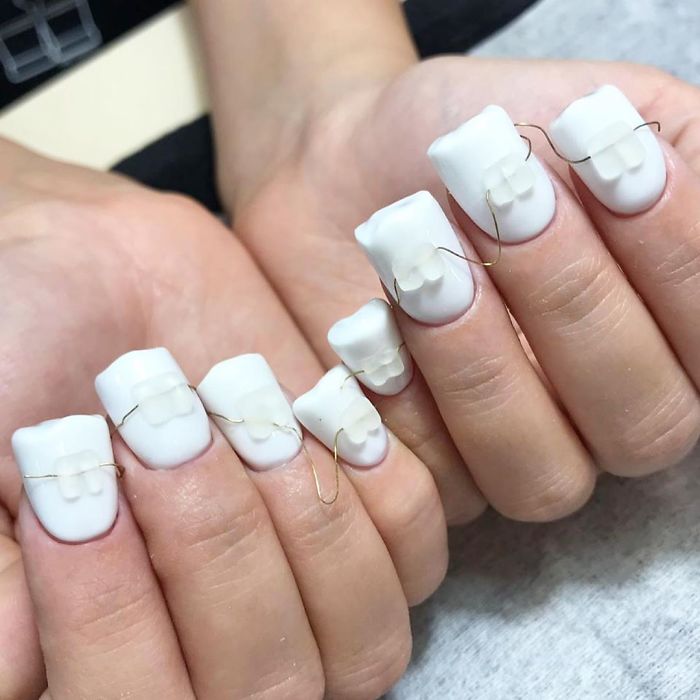 Braces Nails