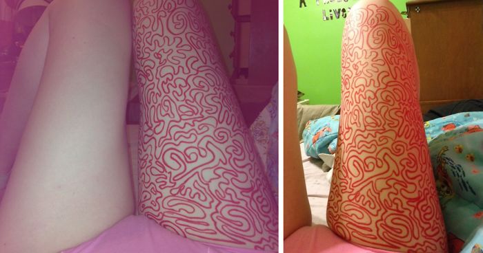Girl Shares Therapist’s Advice To Draw On Her Body Instead Of Cutting