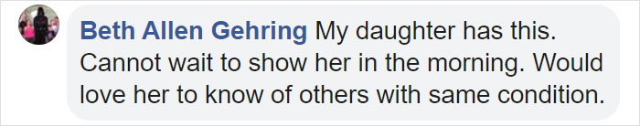 Grandfather With Vitiligo Crochets Dolls To Make Children With This Condition Feel Better Grandfather With Vitiligo Crochets Dolls To Make Children With This Condition Feel Better