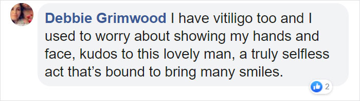 Grandfather With Vitiligo Crochets Dolls To Make Children With This Condition Feel Better Grandfather With Vitiligo Crochets Dolls To Make Children With This Condition Feel Better