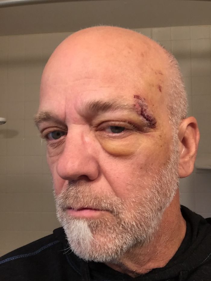 Apparently, Apple Watch Can Detect When The Wearer Is In Danger And That's How It Saved This Man's Life Apparently, Apple Watch Can Detect When The Wearer Is In Danger And That's How It Saved This Man's Life