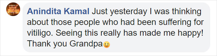 Grandfather With Vitiligo Crochets Dolls To Make Children With This Condition Feel Better Grandfather With Vitiligo Crochets Dolls To Make Children With This Condition Feel Better