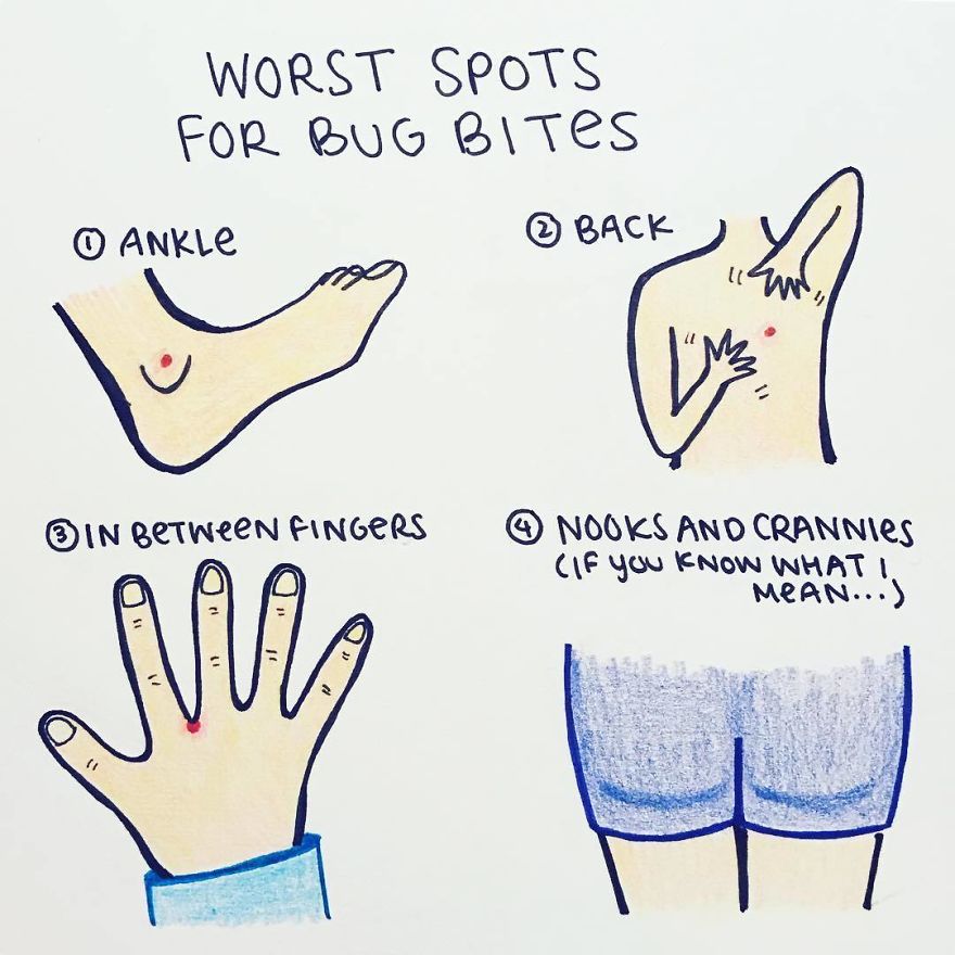 Bug Bites