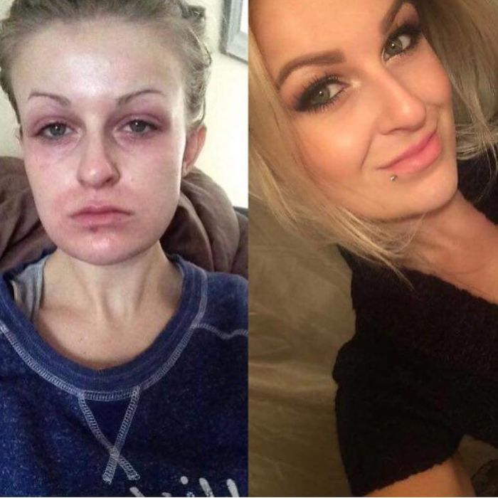 Let’s Hear It For Michelle Who Is Approaching 2 Years Of Sobriety!