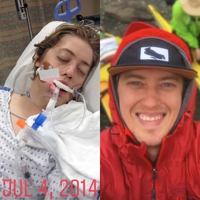 I Just Celebrated 4 Years Of Recovery In July! Recovering Opiate Addict