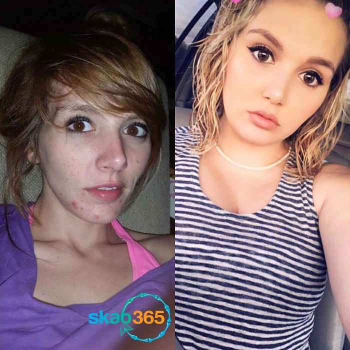 I Was Addicted To Meth For Over 7 Years. I Was Adopted As A Child So I Never Felt Like I Belong. I Found That In Drugs