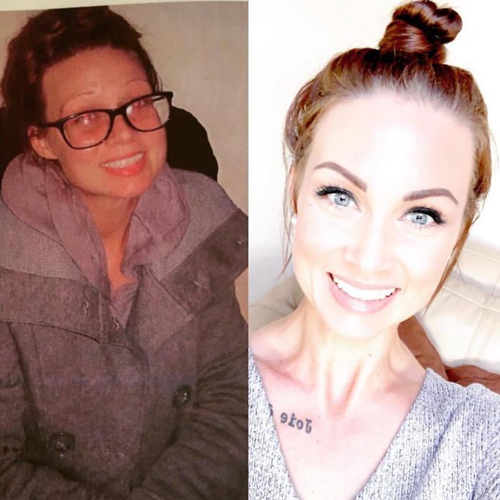 On The Left Is Me On The First Day Of My Last Rehab, String Out On Heroin, Hopeless, Thinking I Would Die With A Needle In My Arm