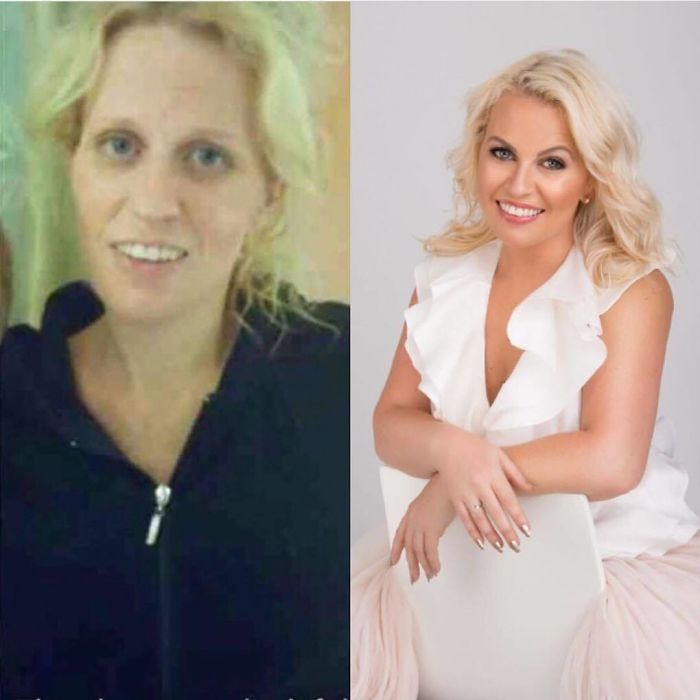 My Addiction Of Meth And Heroin Took Me To Many Bottoms And In December Of 2014 I Was Airlifted To The Hospital And Had To Have Open Heart Surgery. I Was 29 Years Old