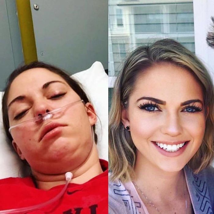 One Year Today Since I Almost Lost My Life