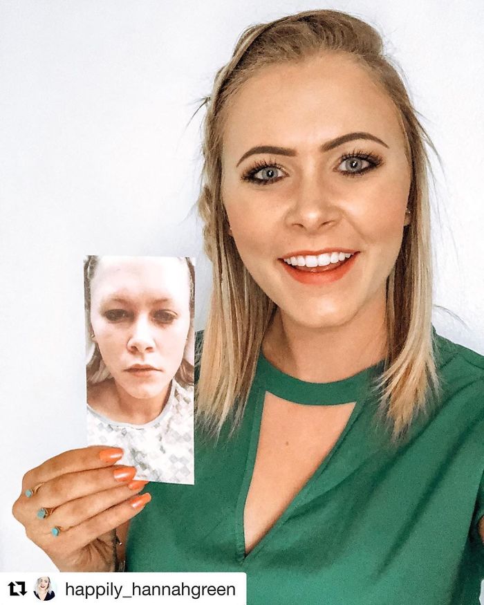 One Year Ago Today I Woke Up In An Uncomfortable Detox Unit Bed In A Drug Rehab Facility