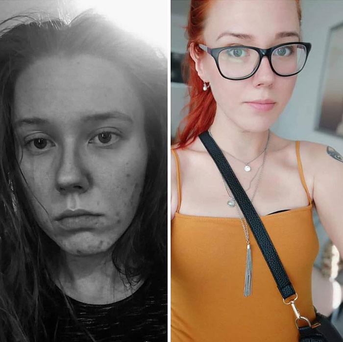 Recovering From Meth Addiction