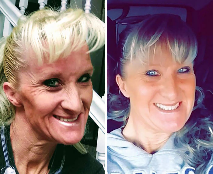 She Is 46-Years-Old And Has 10 Months Clean