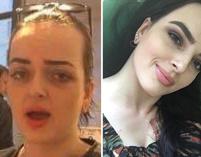 I Refused To Let My Mom Show Me The Picture On The Left For A Long Time Out Of Shame