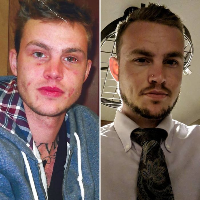 Recovery Works. It's Nice Not To Be Falling Face First In The Street,fighting, Overdosing, Lying, And Hurting Myself And The People In My Lives I Love The Most