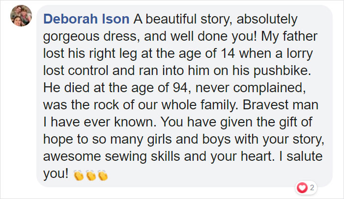 To Encourage A Little Girl Who Was Born Without An Arm, This Woman Shares Stunning Photos Of Herself As Cinderella With A Glass Arm