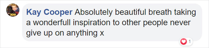 To Encourage A Little Girl Who Was Born Without An Arm, This Woman Shares Stunning Photos Of Herself As Cinderella With A Glass Arm