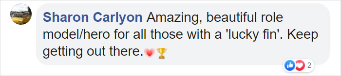 To Encourage A Little Girl Who Was Born Without An Arm, This Woman Shares Stunning Photos Of Herself As Cinderella With A Glass Arm