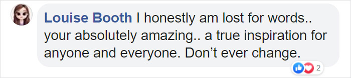 To Encourage A Little Girl Who Was Born Without An Arm, This Woman Shares Stunning Photos Of Herself As Cinderella With A Glass Arm