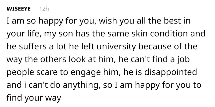 Woman Who Sheds Skin Every Two Weeks Becomes Probably The First Model Who Has This Condition Woman Who Sheds Skin Every Two Weeks Becomes Probably The First Model Who Has This Condition