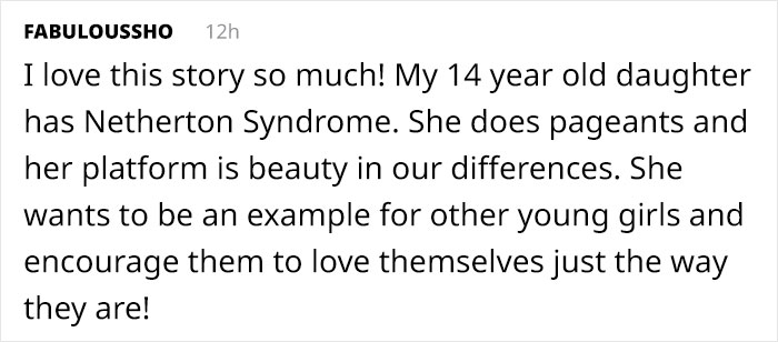 Woman Who Sheds Skin Every Two Weeks Becomes Probably The First Model Who Has This Condition