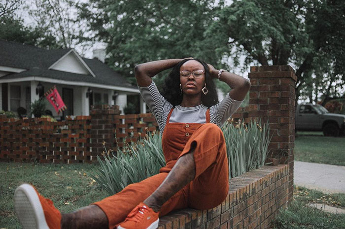 Woman Who Sheds Skin Every Two Weeks Becomes Probably The First Model Who Has This Condition