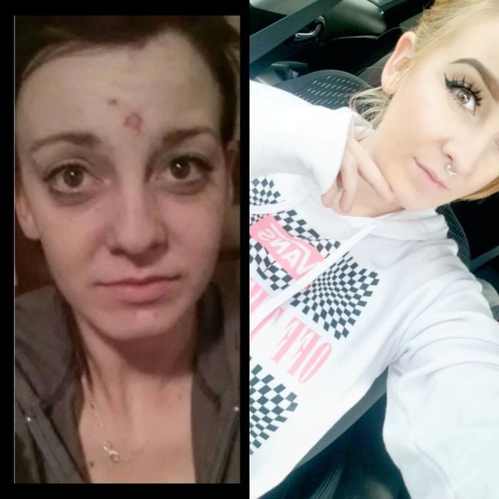 5 Years Ago I Came Clean To My Mom About My Addiction. My Wonderful Boyfriend Helped Put Me Through Detox