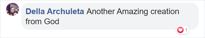 This Baby Zebra Was Born With Spots Instead Of Stripes This Baby Zebra Was Born With Spots Instead Of Stripes