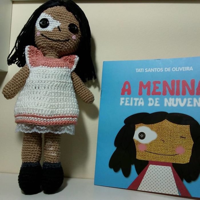 Grandfather With Vitiligo Crochets Dolls To Make Children With This Condition Feel Better Grandfather With Vitiligo Crochets Dolls To Make Children With This Condition Feel Better