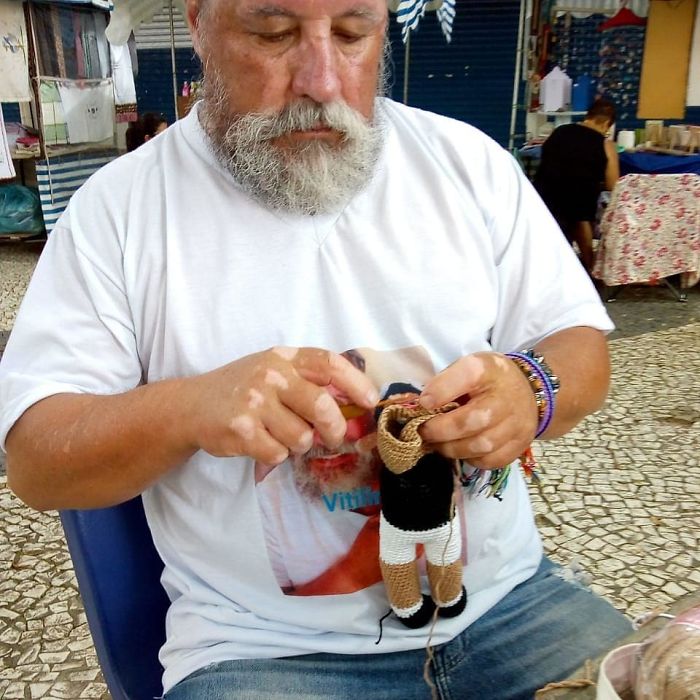 Grandfather With Vitiligo Crochets Dolls To Make Children With This Condition Feel Better Grandfather With Vitiligo Crochets Dolls To Make Children With This Condition Feel Better
