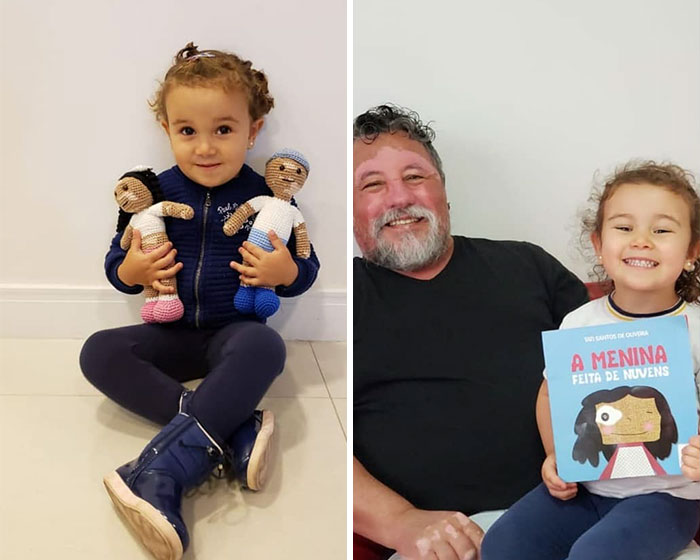 Grandfather With Vitiligo Crochets Dolls To Make Children With This Condition Feel Better Grandfather With Vitiligo Crochets Dolls To Make Children With This Condition Feel Better