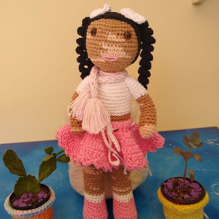 Grandfather With Vitiligo Crochets Dolls To Make Children With This Condition Feel Better Grandfather With Vitiligo Crochets Dolls To Make Children With This Condition Feel Better