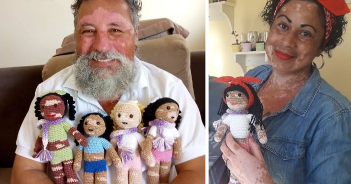 Grandpa With Vitiligo Crochets Dolls To Encourage Kids Who Suffer From This Condition To Accept ThemselvesGrandpa With Vitiligo Crochets Dolls To Encourage Kids Who Suffer From This Condition To Accept Themselves