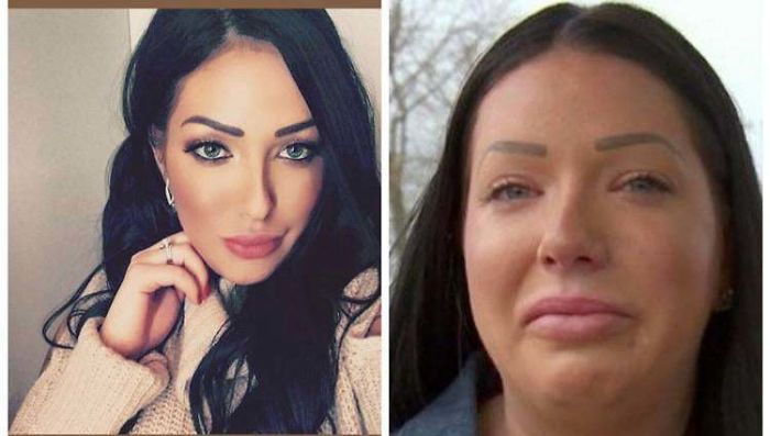 One Of The Best Examples Of Instagram vs. Reality.