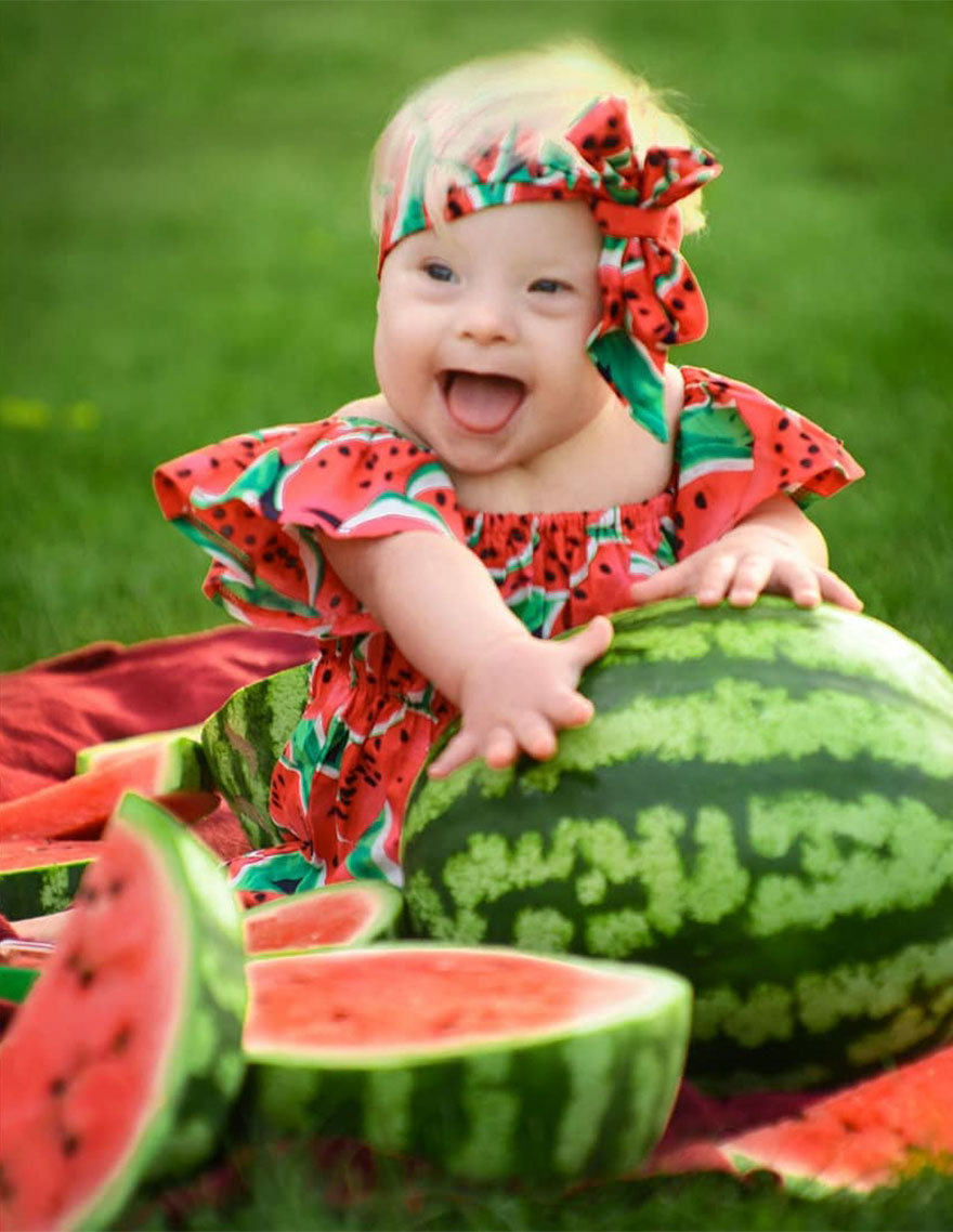 I Design Costumes And Flower Crowns To Photoshoot My Adorable Adopted Girl With Down Syndrome.