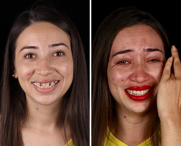 Brazilian Dentist Travels To Treat The Teeth Of Poor People For Free And Here Are 30 Transformations