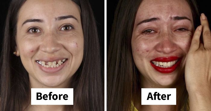 Brazilian Dentist Travels To Treat The Teeth Of Poor People For Free And Here Are 30 Transformations
