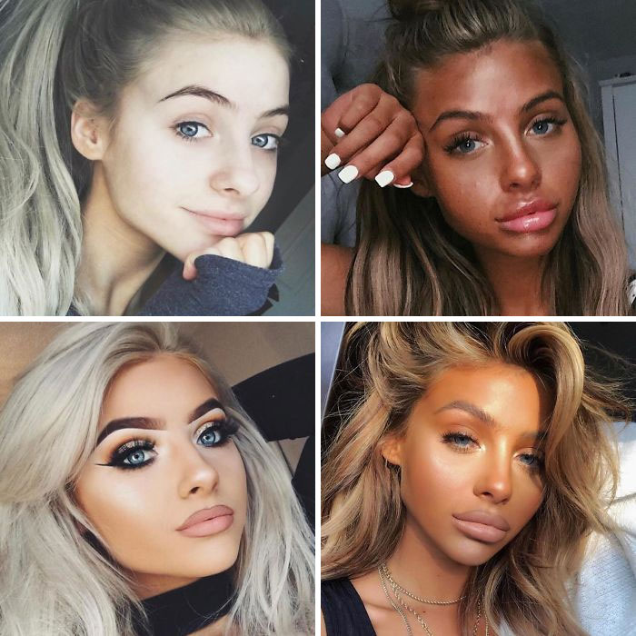 What Happens Over 3 Years As An “Influencer”. Her Skin Looks Burnt To A Crisp