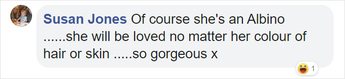 Mexican-American Parents Are Shocked After Giving Birth To A Blond Baby Girl With Light Skin