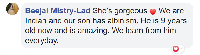 Mexican-American Parents Are Shocked After Giving Birth To A Blond Baby Girl With Light Skin